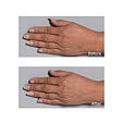 Perricone MD Cold Plasma Plus+ Hand Therapy 59 ml