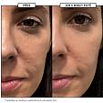 Dr. LEVY Fire &amp; Snow 2 Steps: Peel &amp; Serum 4 x 10 ml