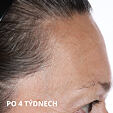 Perricone MD Essential Fx Acyl- Glutathione Chia Oil 30 ml
