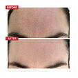 Dr. LEVY Skin Reset Treatments 3Deep™ Cell Renewal Micro-Resurfacing Cleanser 150 ml