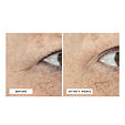 Perricone MD Essential Fx Acyl-Glutathione Eyelid Lift Serum 15 ml