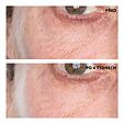 Perricone MD High Potency Retinol Recovery Overnight Moisturizer 59 ml