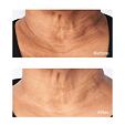 Perricone MD Cold Plasma Plus+ Sub-D/Neck 59 ml