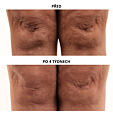 Perricone MD Essential Fx Acyl- Glutathione Chia Body Oil 118 ml