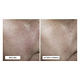 Perricone MD No:Rinse Intensive Pore Minimizing Toner 118 ml