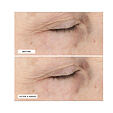 Perricone MD Essential Fx Acyl-Glutathione Smoothing &amp; Brightening Under-Eye Cream 15 ml